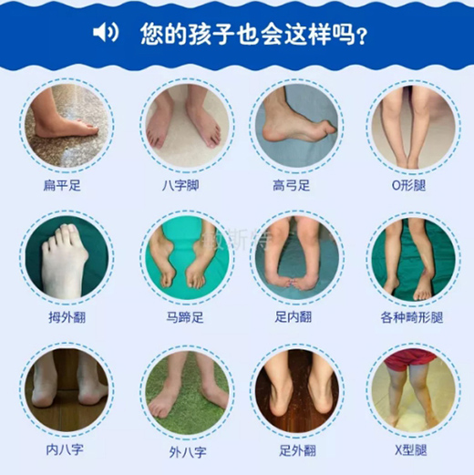 耐樂途功能鞋 關注兒童足部健康